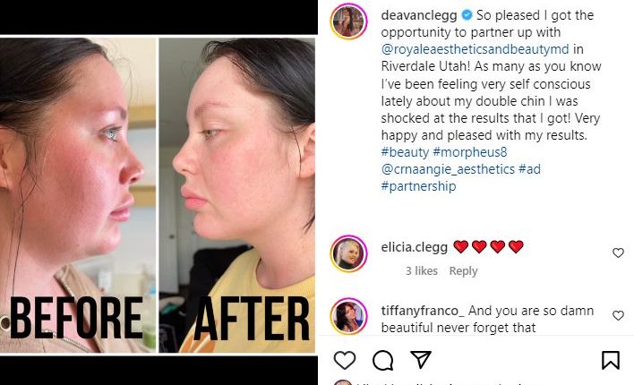 deavan-clegg-before-and-after