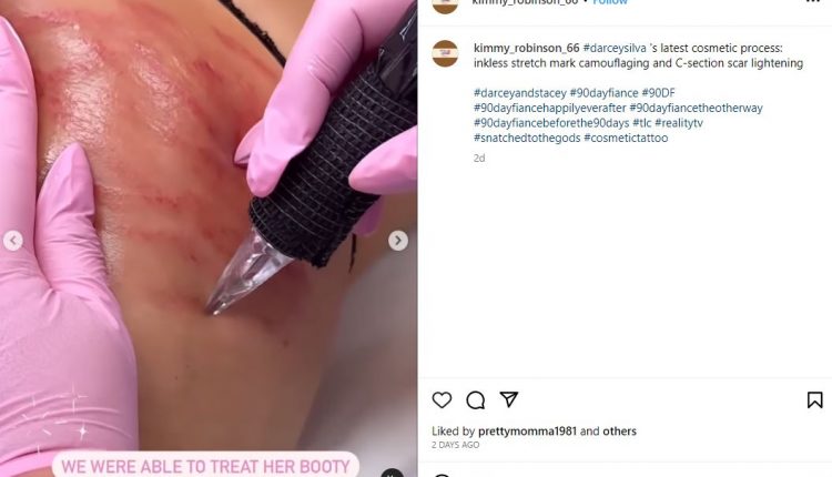 kimmy_robinson_66-stretch-marks