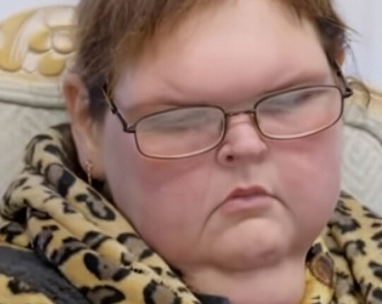 Tammy Slaton Sulks Over Skin Surgery Denial – 1000-Lb Sisters – TLC