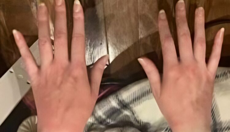 Red hands shared by Amy Eskridge via NewsNation – YouTube